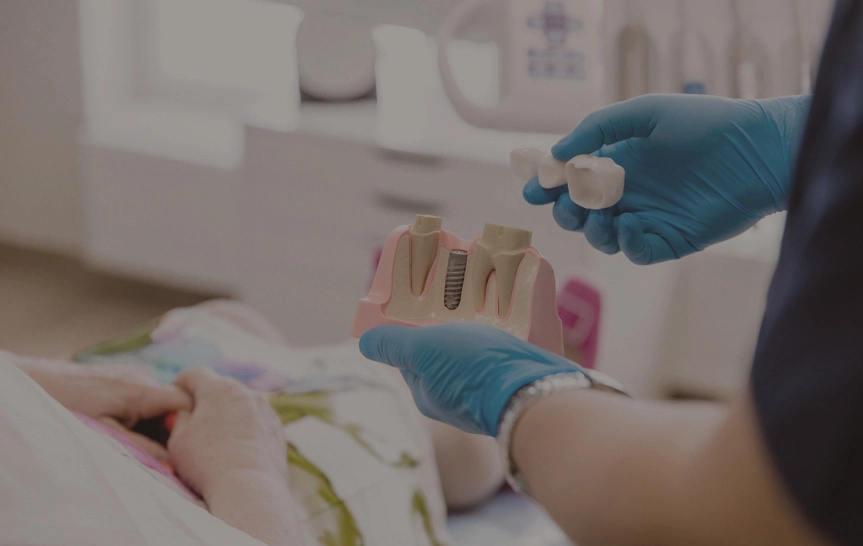 Fogászati híd, fogpótlások